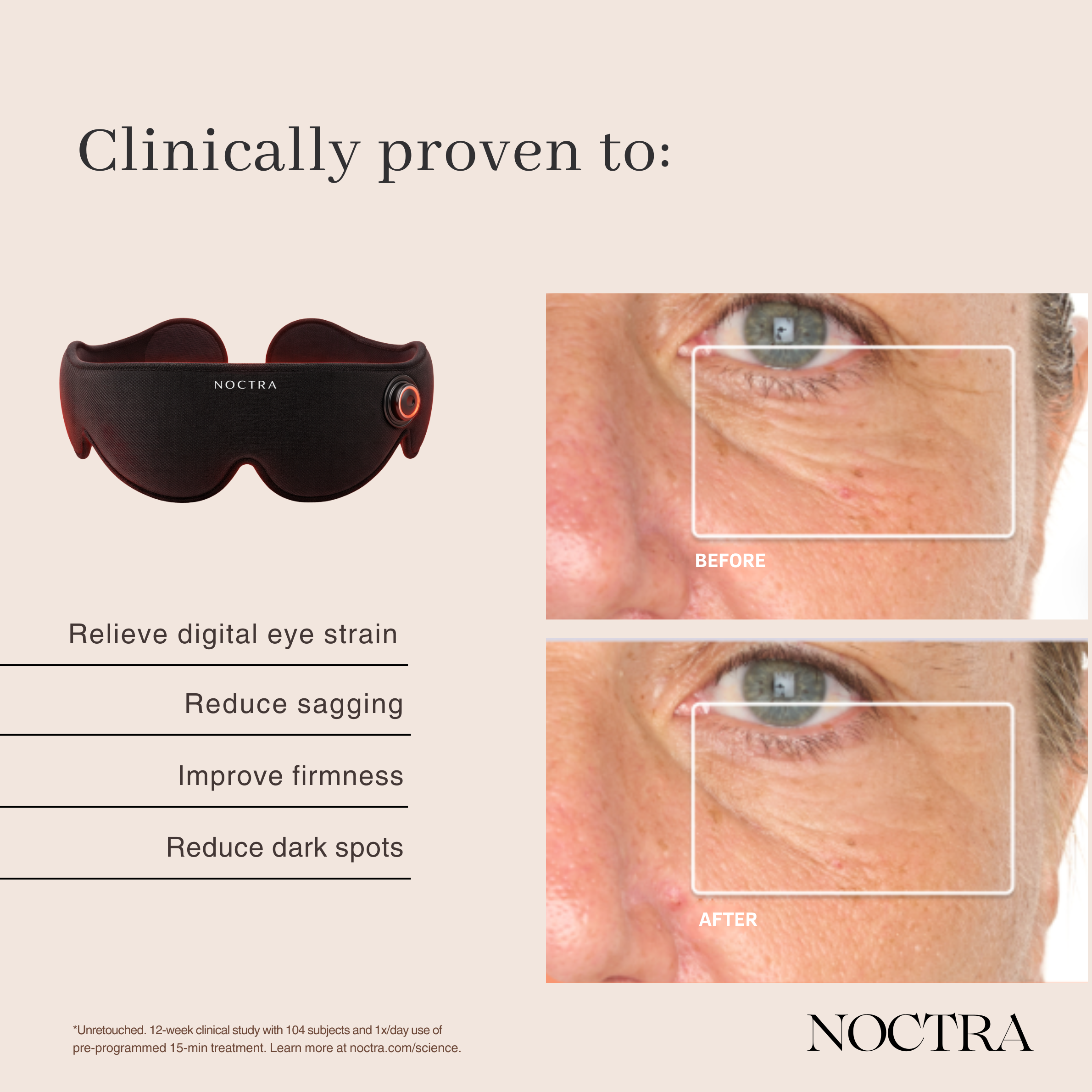 NOCTRA™ Ocular Reset